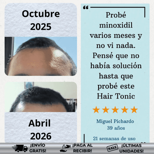 OmHair® | Tratamiento eficaz para caída del cabello