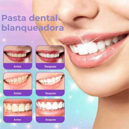 GlumiDent® | Pasta Dental Blanqueadora de Sonrisa
