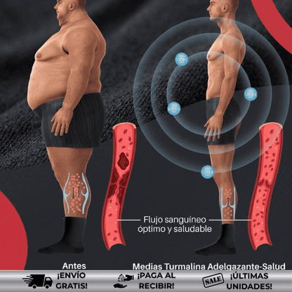 VarisOff™ | Medias con Tecnología de Drenaje y Acupresión para Piernas Libres de Varices
