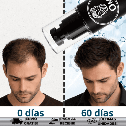 OmHair® | Tratamiento eficaz para caída del cabello
