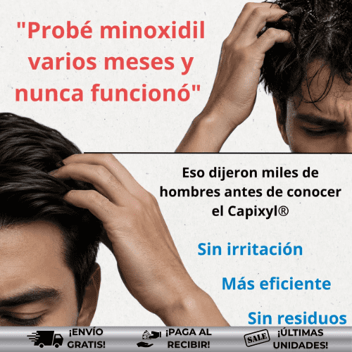 OmHair® | Tratamiento eficaz para caída del cabello