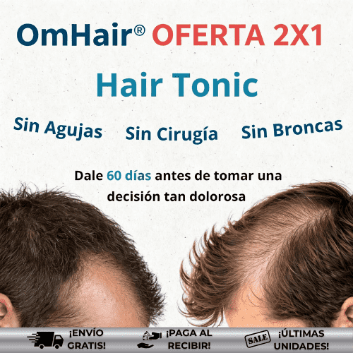 OmHair® | Tratamiento eficaz para caída del cabello
