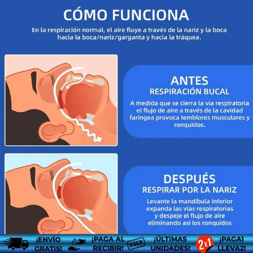 SleepQuiet™ ¡Oferta 2x1! | Dispositivo Bucal Anti-Ronquidos