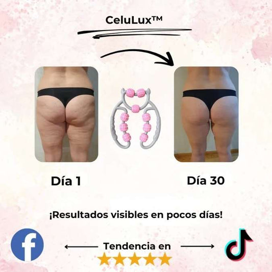 CeluLux™ | La Forma Más Fácil de Reducir la Celulitis